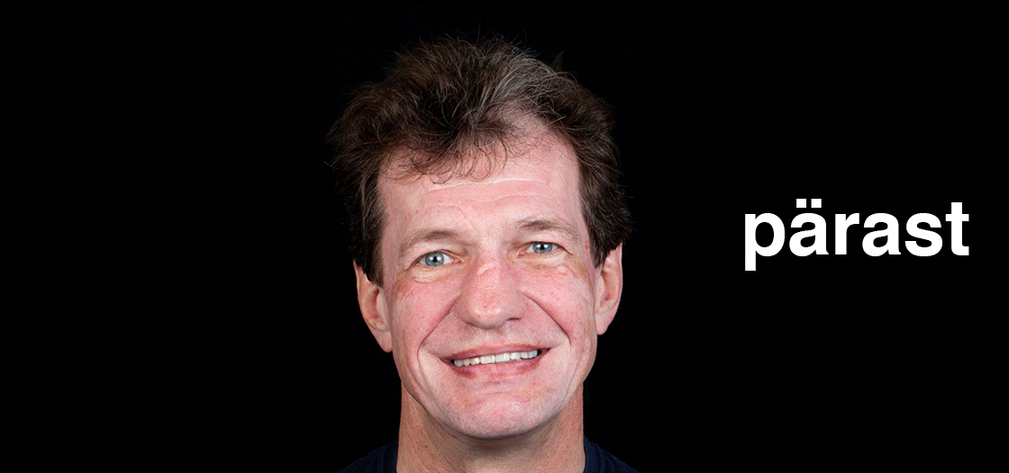 Case 2 - Implantatsioon. Kompleksne naeratuse taastamine 7 Meerhof Dental Center Case 2 – Implantatsioon. Kompleksne naeratuse taastamine - https://staging.meerhofdk.ee/case-2-implantatsioon-kompleksne-naeratuse-taastamine/